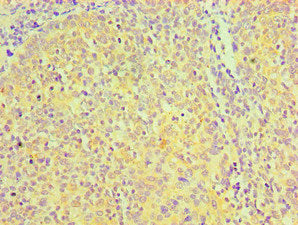 CD81 Monoclonal Antibody