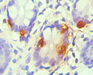 CHGA Monoclonal Antibody