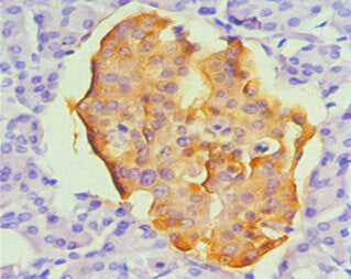 CHGA Monoclonal Antibody