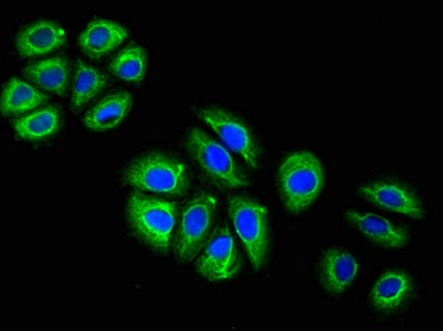 GFAP Monoclonal Antibody