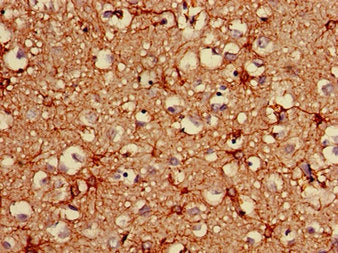 GFAP Monoclonal Antibody
