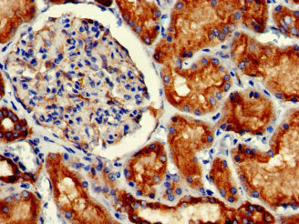 GFAP Monoclonal Antibody