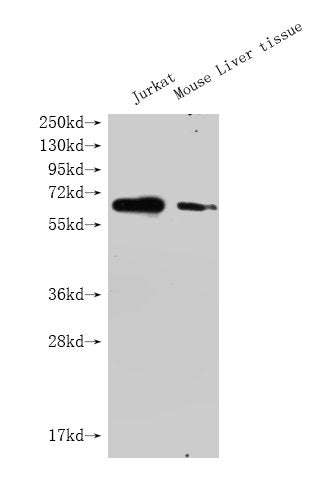GPC3 Monoclonal Antibody