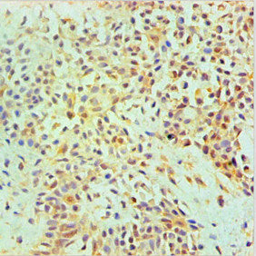 ANXA2 Monoclonal Antibody