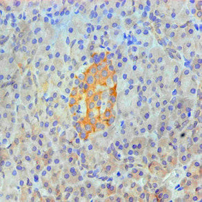 ANXA2 Monoclonal Antibody