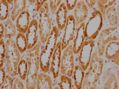 HSPA8 Monoclonal Antibody