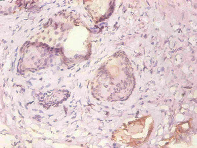 KRT19 Monoclonal Antibody