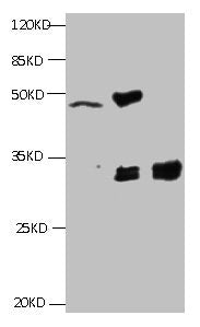 KRT19 Monoclonal Antibody