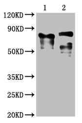 LAG3 Monoclonal Antibody