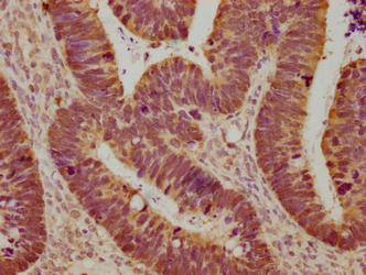 LGALS3 Monoclonal Antibody