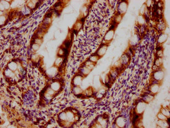 LGALS3 Monoclonal Antibody