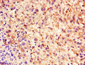 NES Monoclonal Antibody