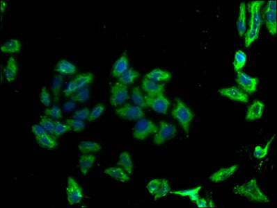 PD-L2 Monoclonal Antibody