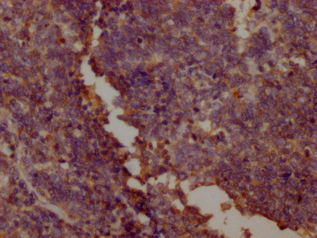 PKM Monoclonal Antibody