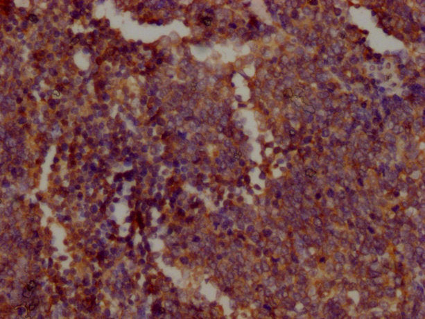 PKM Monoclonal Antibody