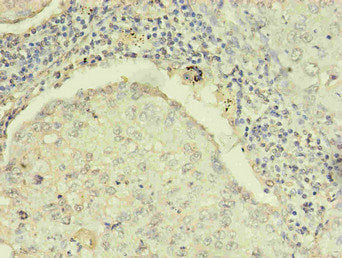 RRM1 Monoclonal Antibody