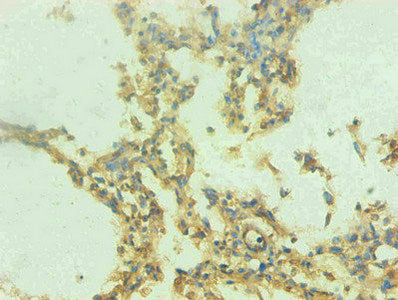 S100A9 Monoclonal Antibody