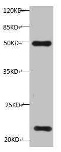TIMP1 Monoclonal Antibody
