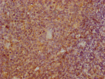 TNFRSF17 Monoclonal Antibody