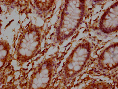 TNFRSF17 Monoclonal Antibody