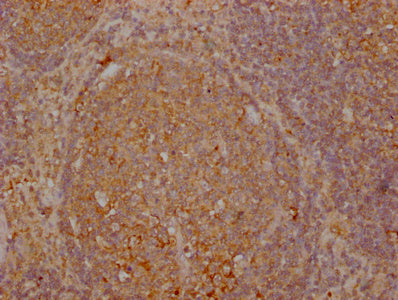 TNFRSF17 Monoclonal Antibody