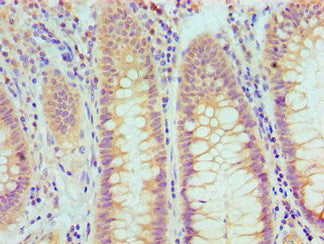 TP53 Monoclonal Antibody