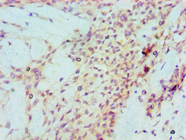 TP53 Monoclonal Antibody