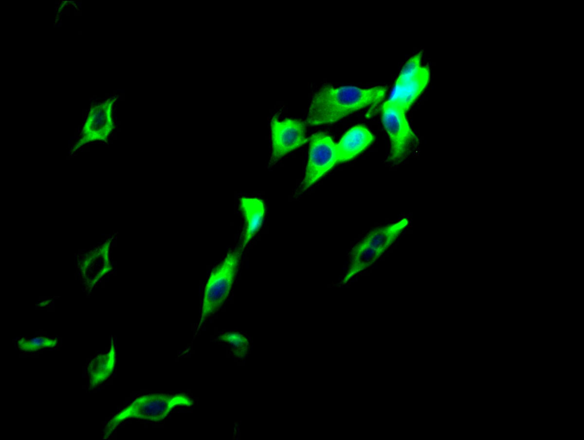 TUBB  Monoclonal Antibody