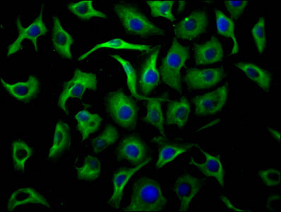 TUBB  Monoclonal Antibody