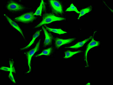 TUBB  Monoclonal Antibody