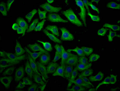 TUBB  Monoclonal Antibody