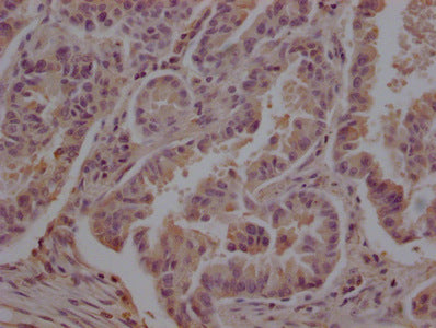 TUBB  Monoclonal Antibody