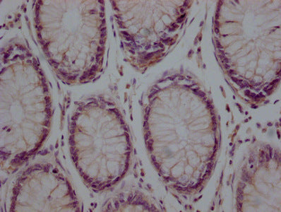 TUBB  Monoclonal Antibody