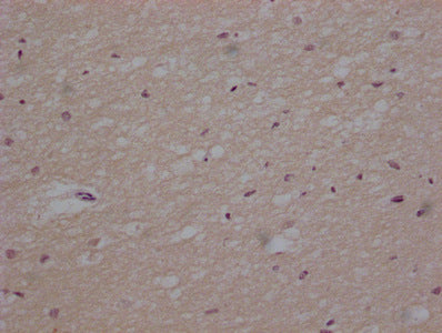 TUBB  Monoclonal Antibody