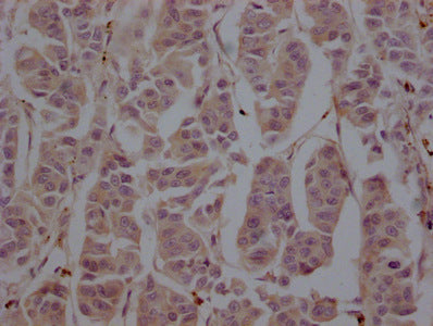 TUBB  Monoclonal Antibody