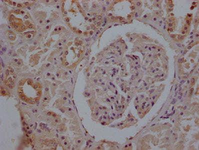 TUBB  Monoclonal Antibody