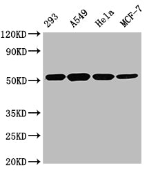 TUBB  Monoclonal Antibody