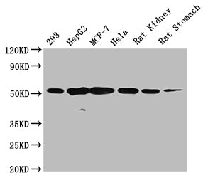 TUBB  Monoclonal Antibody