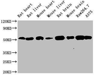TUBB  Monoclonal Antibody