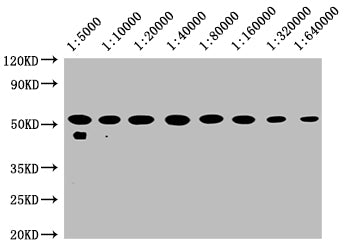 TUBB  Monoclonal Antibody