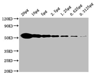TUBB  Monoclonal Antibody