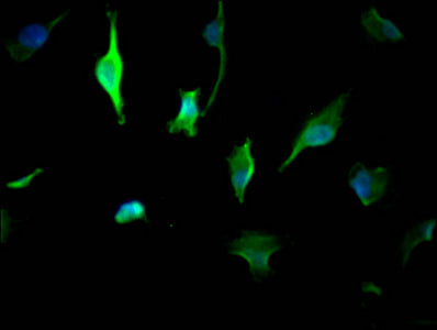 YWHAZ Monoclonal Antibody