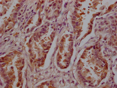 YWHAZ Monoclonal Antibody