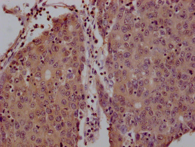 YWHAZ Monoclonal Antibody