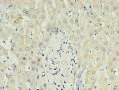 CRP Monoclonal Antibody