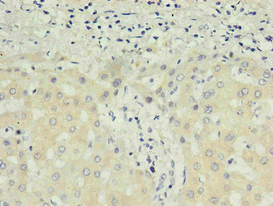AFP Monoclonal Antibody