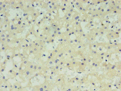 AFP Monoclonal Antibody