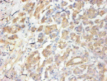 CCL2 Monoclonal Antibody