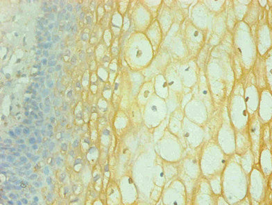 IFNG Monoclonal Antibody