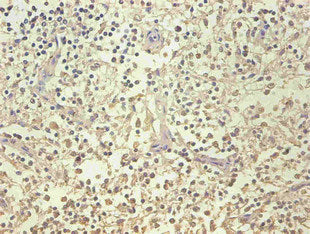 LCN2 Monoclonal Antibody